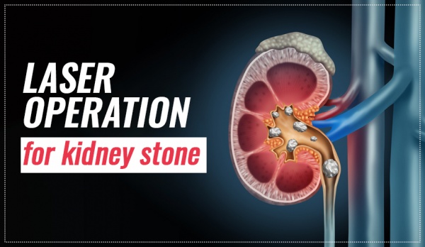 https://www.worldofurology.in/blogvats-10-why-you-should-opt-for-laser-operation-for-kidney-stone