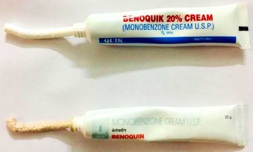  Benoquin Cream For Vitiligo